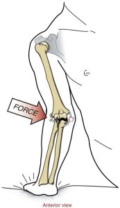 (Musculoskeletalkey.com)